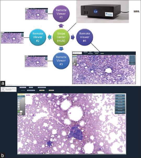 https://cdn.ncbi.nlm.nih.gov/pmc/blobs/b778/5609353/b9cc9c78e2b1/JPI-8-33-g001.jpg