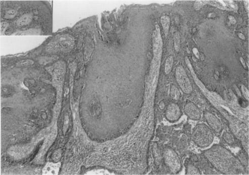 https://cdn.ncbi.nlm.nih.gov/pmc/blobs/b77a/501500/2bb52262420f/jclinpath00280-0059-a.jpg