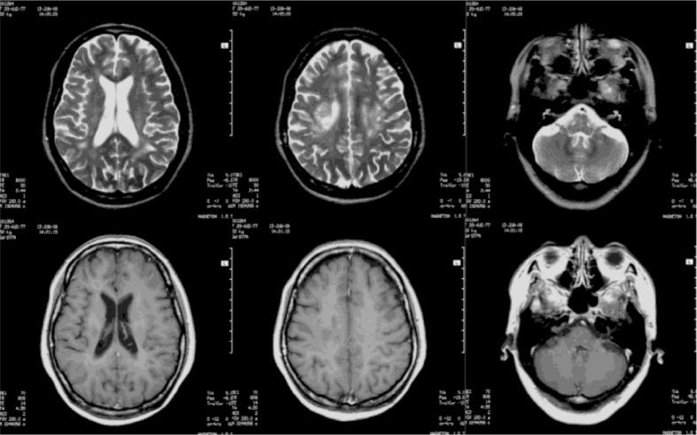 https://cdn.ncbi.nlm.nih.gov/pmc/blobs/b77c/4366481/2b38c76d5821/SNP-5-26210-g003.jpg