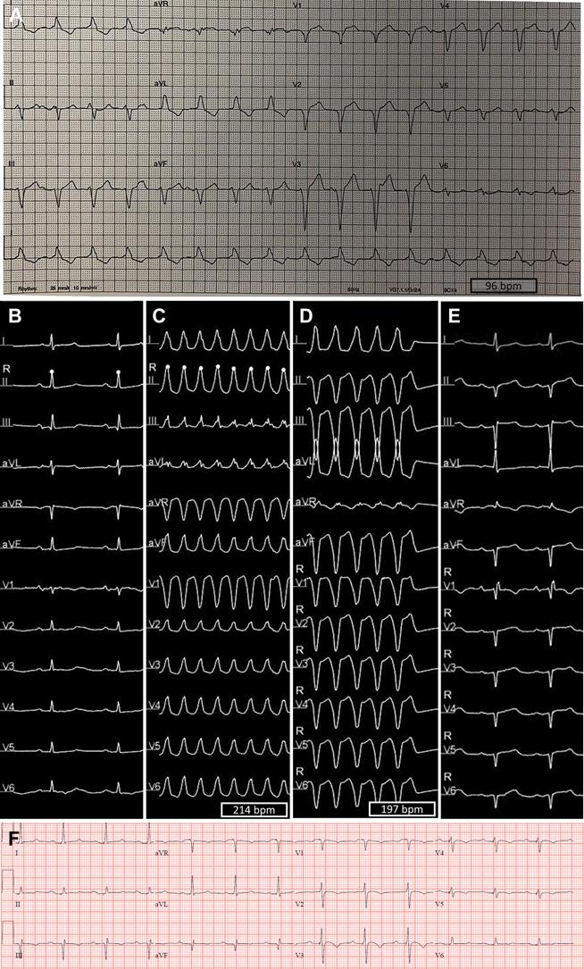 https://cdn.ncbi.nlm.nih.gov/pmc/blobs/b77f/11101844/e837378bb8db/ga1.jpg