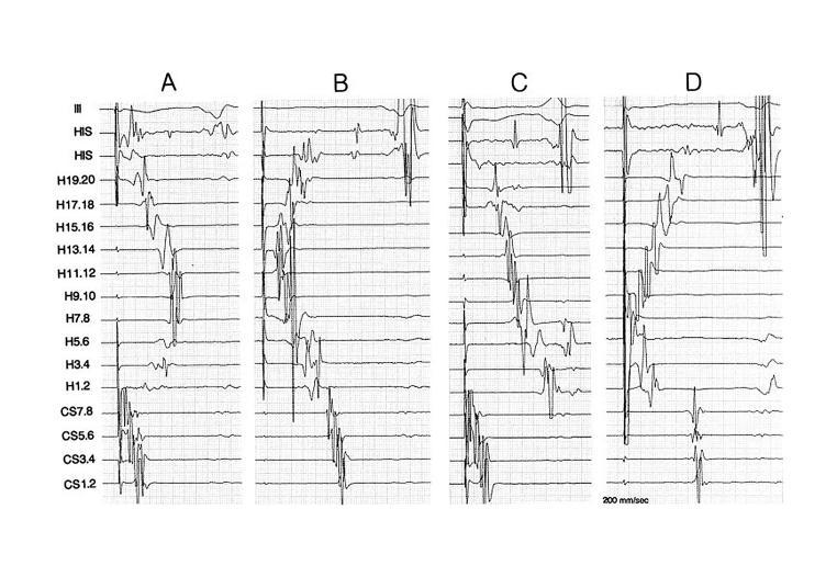 https://cdn.ncbi.nlm.nih.gov/pmc/blobs/b781/1564056/6f5f849e83b1/ipej020085-01.jpg