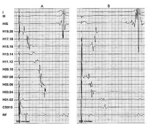 https://cdn.ncbi.nlm.nih.gov/pmc/blobs/b781/1564056/e3707a449349/ipej020085-04.jpg