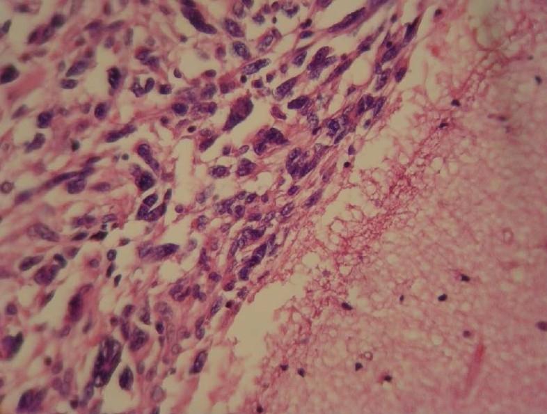 https://cdn.ncbi.nlm.nih.gov/pmc/blobs/b782/3263113/c4e9a8f607c7/JRMS-16-968-g003.jpg
