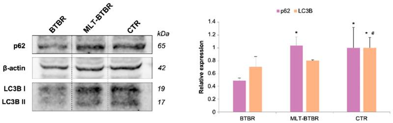 https://cdn.ncbi.nlm.nih.gov/pmc/blobs/b783/11640888/6acd85a15929/ijms-25-12598-g003.jpg