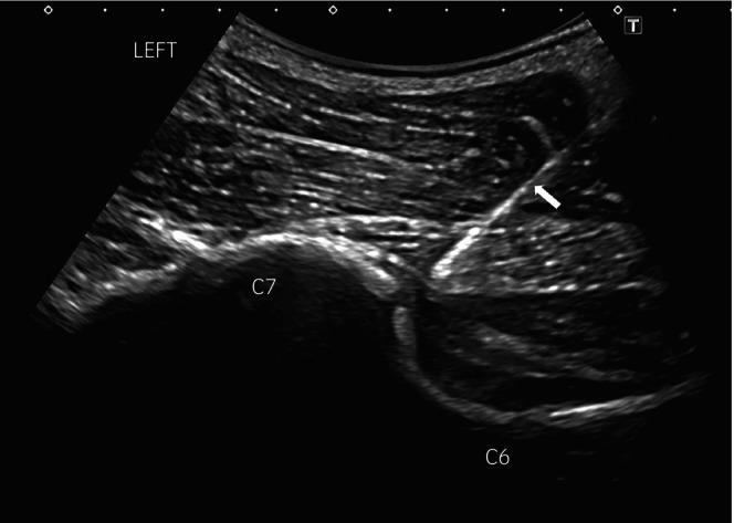 https://cdn.ncbi.nlm.nih.gov/pmc/blobs/b78c/11807926/b240a23e8722/EVJ-57-398-g001.jpg