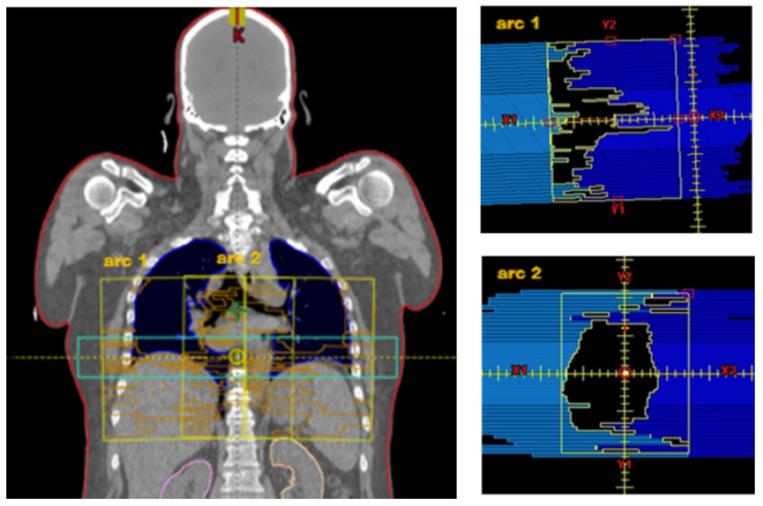 https://cdn.ncbi.nlm.nih.gov/pmc/blobs/b78f/10486387/01f831889f77/cancers-15-04220-g001.jpg