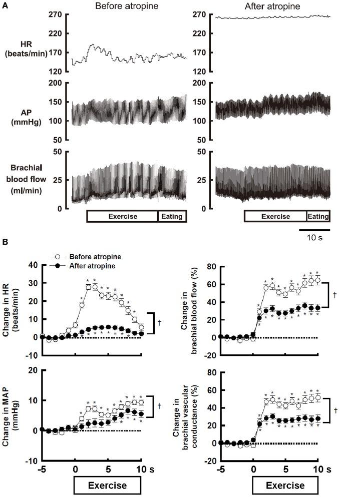https://cdn.ncbi.nlm.nih.gov/pmc/blobs/b791/3573268/0630a88a4861/fphys-04-00023-g0001.jpg
