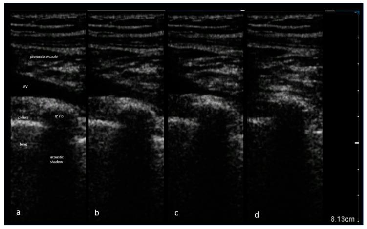 https://cdn.ncbi.nlm.nih.gov/pmc/blobs/b795/10606423/5fd6e8a5340d/diagnostics-13-03274-g001.jpg