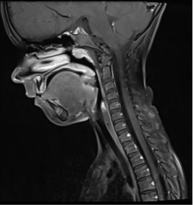 https://cdn.ncbi.nlm.nih.gov/pmc/blobs/b796/11090221/4b56306bb891/acc-62_supp1-113-f1.jpg