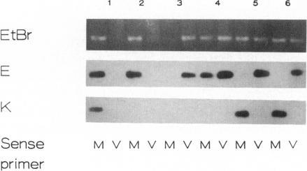 https://cdn.ncbi.nlm.nih.gov/pmc/blobs/b7a0/1682379/ca0680baa443/ajhg00055-0044-a.jpg