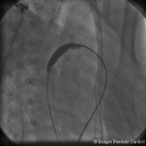 https://cdn.ncbi.nlm.nih.gov/pmc/blobs/b7a1/3232595/401d8825d360/IPC-13-1-g005.jpg