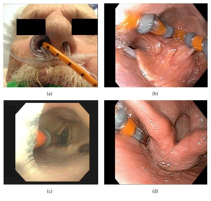 https://cdn.ncbi.nlm.nih.gov/pmc/blobs/b7a8/6106847/11811d8b388d/CRIGM2018-9720243.001.jpg
