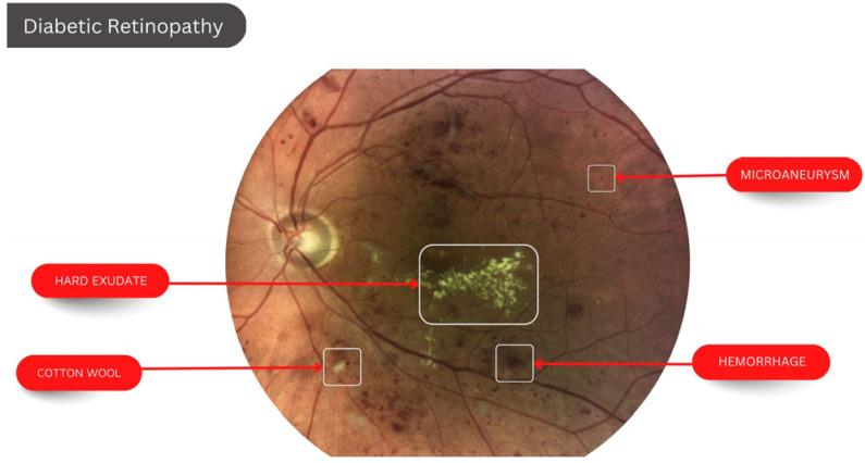 https://cdn.ncbi.nlm.nih.gov/pmc/blobs/b7ac/9914220/0febbe8dd491/diagnostics-13-00393-g001.jpg
