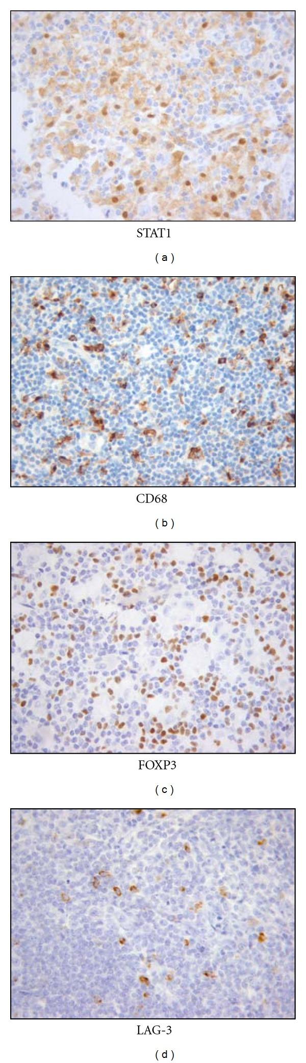 https://cdn.ncbi.nlm.nih.gov/pmc/blobs/b7bf/3426211/ef80561585a3/CDI2012-756353.003.jpg