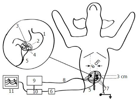 https://cdn.ncbi.nlm.nih.gov/pmc/blobs/b7c3/5504367/731c23164efd/WJG-23-4517-g004.jpg