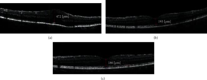https://cdn.ncbi.nlm.nih.gov/pmc/blobs/b7c8/7603613/0e6ea58f9a8e/joph2020-6871207.001.jpg