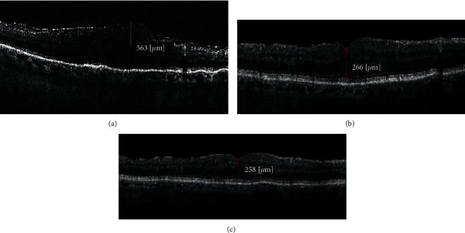 https://cdn.ncbi.nlm.nih.gov/pmc/blobs/b7c8/7603613/39551e0806d7/joph2020-6871207.002.jpg