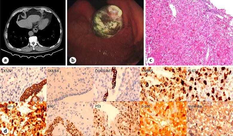 https://cdn.ncbi.nlm.nih.gov/pmc/blobs/b7cb/12140611/533ba2db29c8/cop-2025-0016-0001-545942_F03.jpg