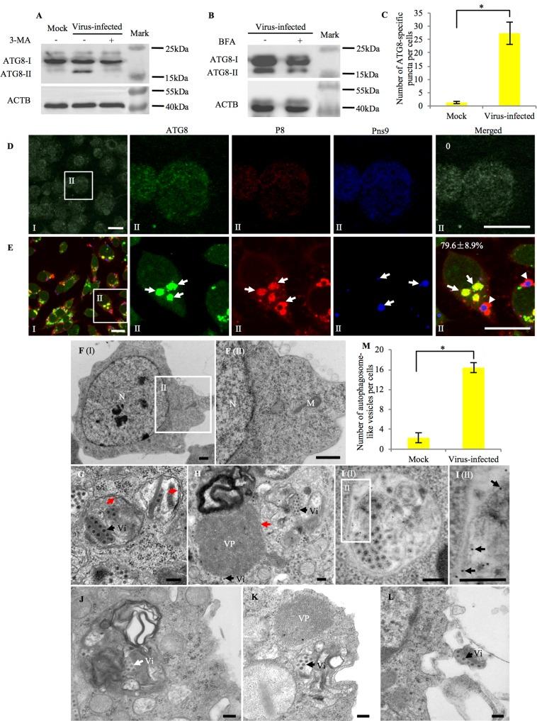 https://cdn.ncbi.nlm.nih.gov/pmc/blobs/b7cc/5708841/37612daa6d1e/ppat.1006727.g001.jpg