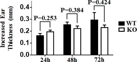 https://cdn.ncbi.nlm.nih.gov/pmc/blobs/b7d6/5122327/0e915ae46e6a/oncotarget-07-37498-g006.jpg