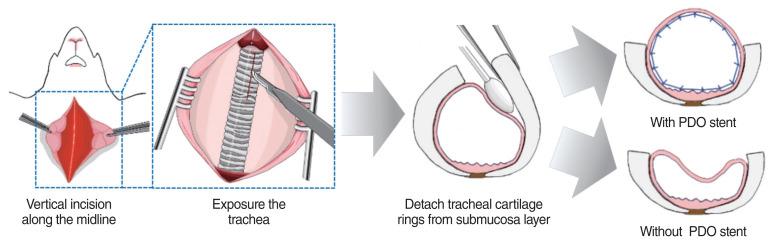 https://cdn.ncbi.nlm.nih.gov/pmc/blobs/b7d6/8373836/478ea6889004/ceo-2020-01627f3.jpg