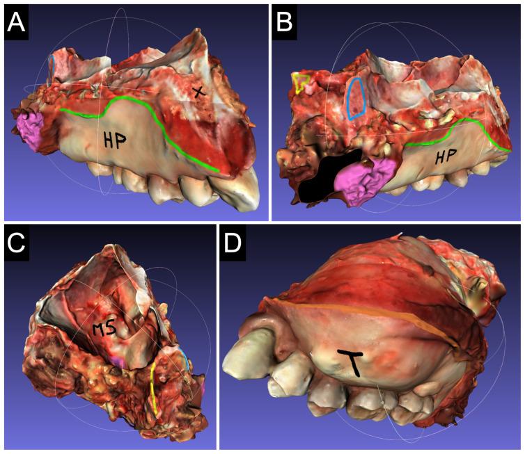 https://cdn.ncbi.nlm.nih.gov/pmc/blobs/b7d7/11718930/18ed504a0295/cancers-17-00014-g004.jpg