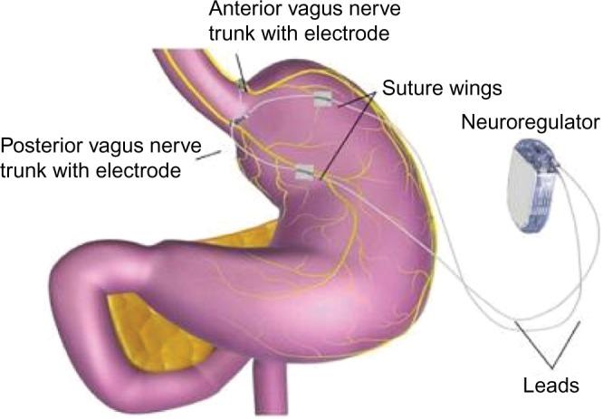 https://cdn.ncbi.nlm.nih.gov/pmc/blobs/b7dc/4993556/13e57e413598/mder-9-291Fig7.jpg