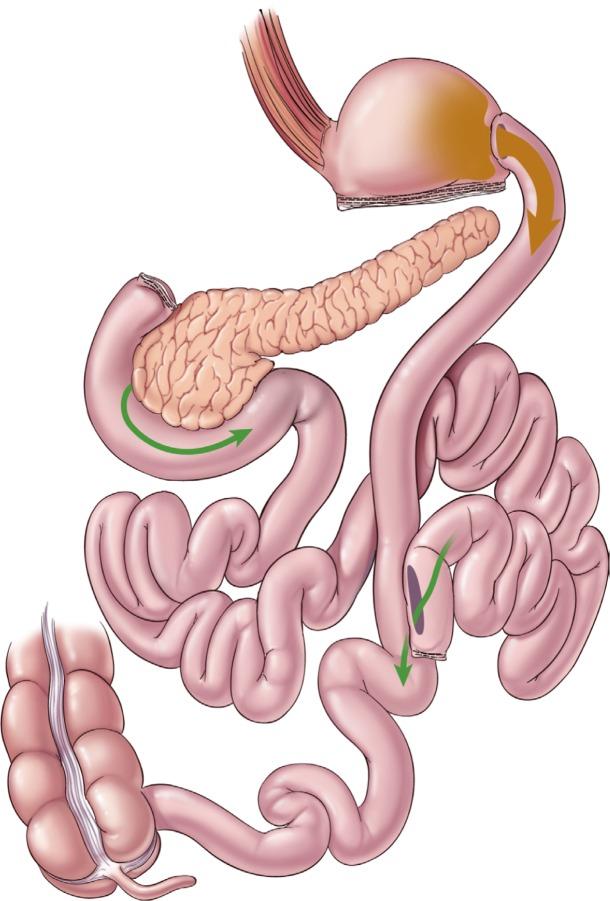 https://cdn.ncbi.nlm.nih.gov/pmc/blobs/b7dc/4993556/1b7f2498f39f/mder-9-291Fig4.jpg