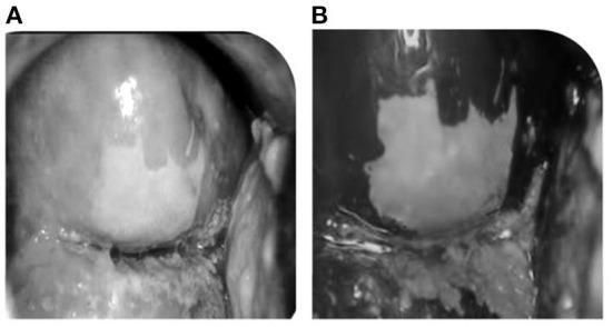 https://cdn.ncbi.nlm.nih.gov/pmc/blobs/b7e3/9651910/5513c796c01c/fpubh-10-1030304-g0003.jpg
