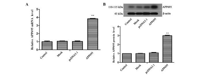 https://cdn.ncbi.nlm.nih.gov/pmc/blobs/b7eb/4626184/0577daece027/MMR-12-05-7615-g00.jpg