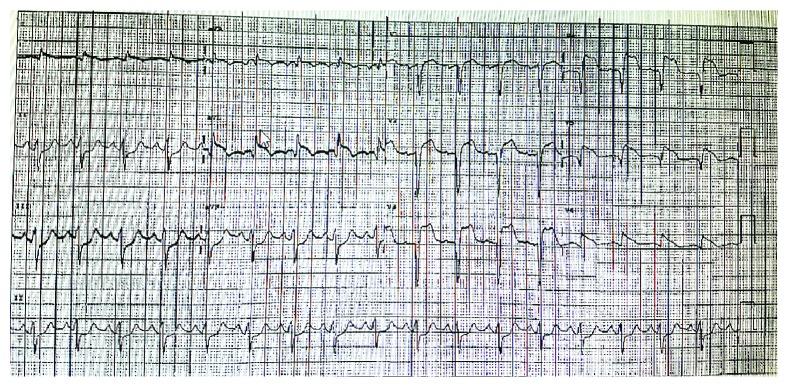 https://cdn.ncbi.nlm.nih.gov/pmc/blobs/b7eb/6362489/f9dc7cd8b82c/CRIC2019-9656387.001.jpg