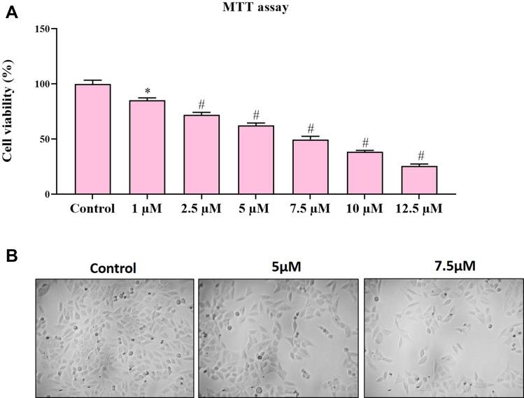 https://cdn.ncbi.nlm.nih.gov/pmc/blobs/b7eb/7602902/a7ebbb71599b/IJN-15-8249-g0008.jpg
