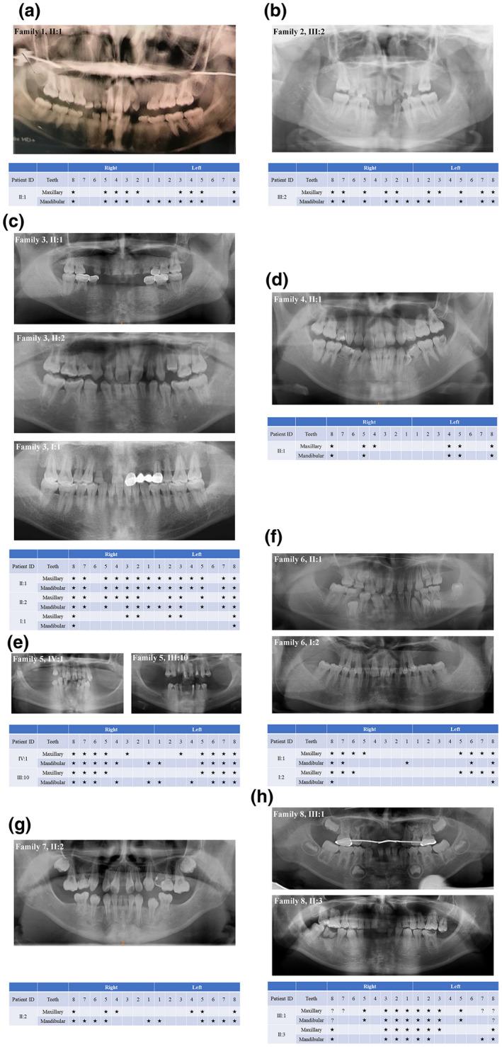 https://cdn.ncbi.nlm.nih.gov/pmc/blobs/b7f6/9544223/747dee5cd4a6/MGG3-10-e2045-g003.jpg