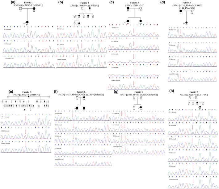 https://cdn.ncbi.nlm.nih.gov/pmc/blobs/b7f6/9544223/984a23983b60/MGG3-10-e2045-g001.jpg
