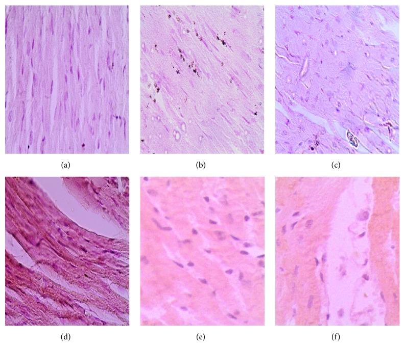 https://cdn.ncbi.nlm.nih.gov/pmc/blobs/b80a/4736207/4f0d8adac2df/JT2015-424813.004.jpg