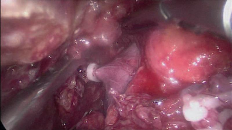 https://cdn.ncbi.nlm.nih.gov/pmc/blobs/b80b/5671865/25fc119aa746/medi-96-e8378-g004.jpg