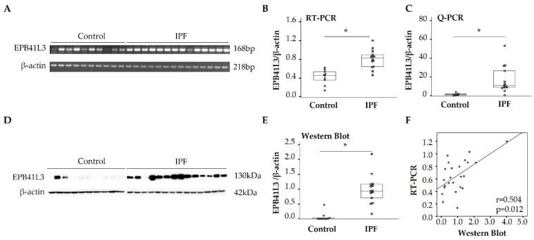 https://cdn.ncbi.nlm.nih.gov/pmc/blobs/b80f/10298908/037f392677fb/ijms-24-10182-g001.jpg
