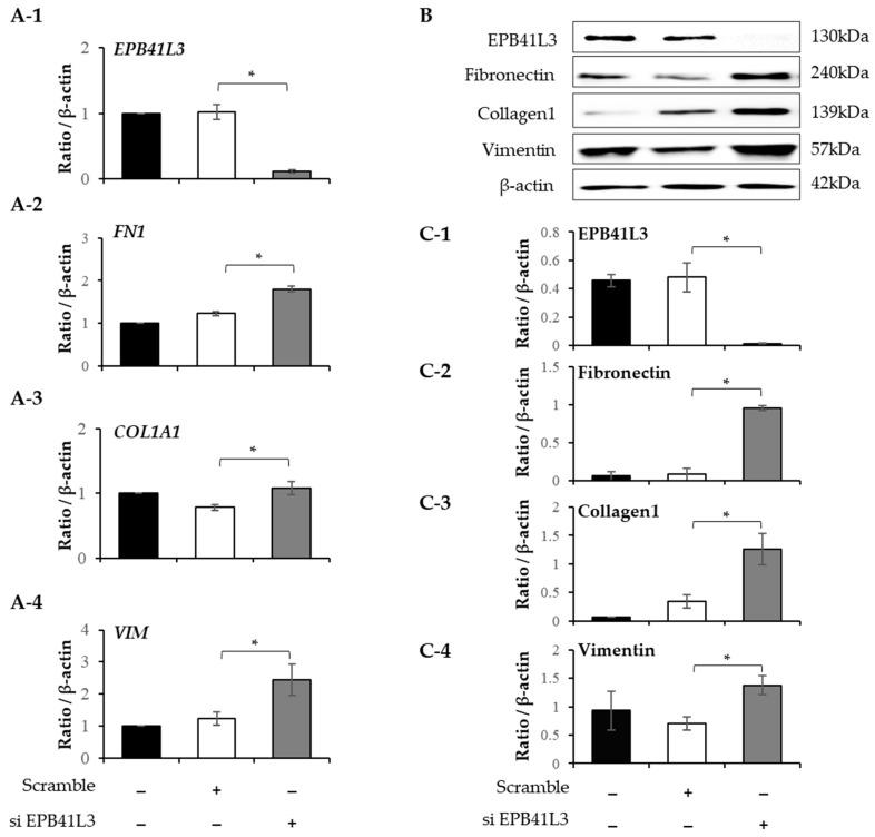 https://cdn.ncbi.nlm.nih.gov/pmc/blobs/b80f/10298908/0e71db8b5ccc/ijms-24-10182-g007.jpg