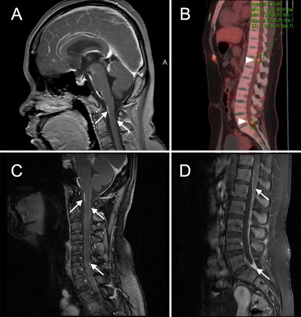https://cdn.ncbi.nlm.nih.gov/pmc/blobs/b80f/11670131/0f42ff32ec9a/CASE24701_figure_2.jpg