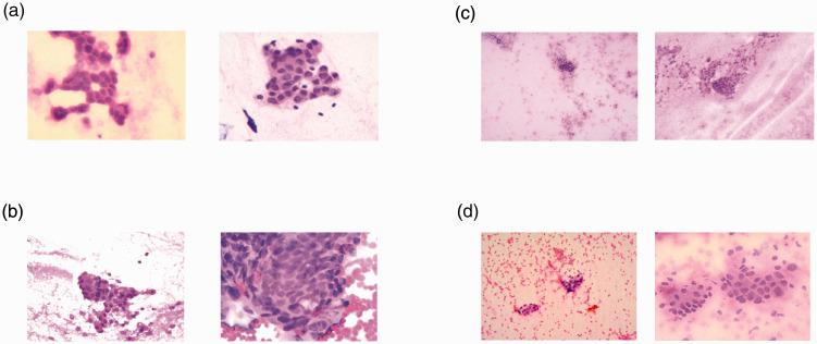 https://cdn.ncbi.nlm.nih.gov/pmc/blobs/b816/7876769/419aa2fb52bb/10.1177_0300060520987771-fig1.jpg