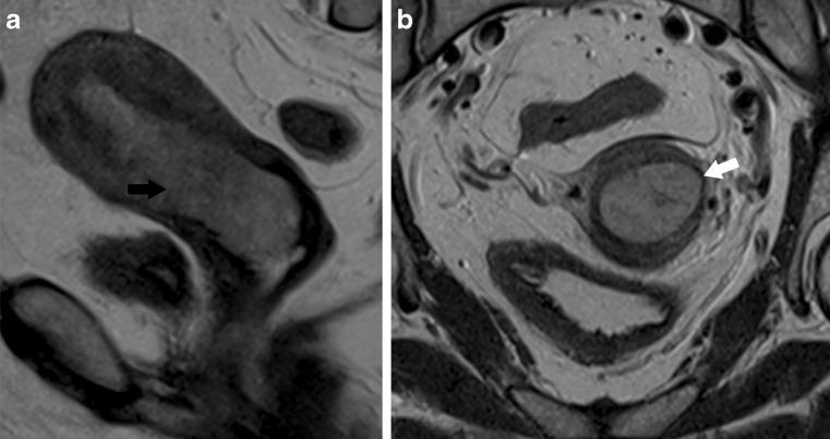 https://cdn.ncbi.nlm.nih.gov/pmc/blobs/b817/3288867/1212a741159d/13244_2010_42_Fig5_HTML.jpg