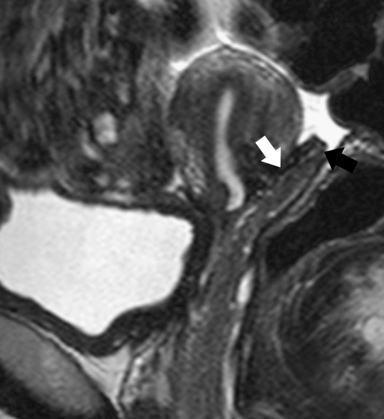 https://cdn.ncbi.nlm.nih.gov/pmc/blobs/b817/3288867/ca128cc320c1/13244_2010_42_Fig23_HTML.jpg