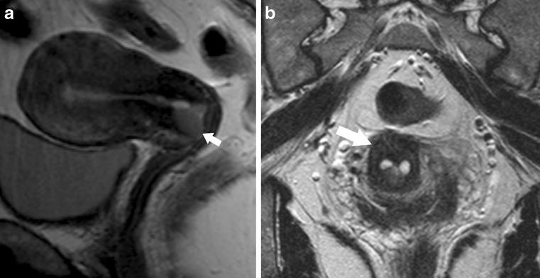 https://cdn.ncbi.nlm.nih.gov/pmc/blobs/b817/3288867/cef7abbb53eb/13244_2010_42_Fig11_HTML.jpg