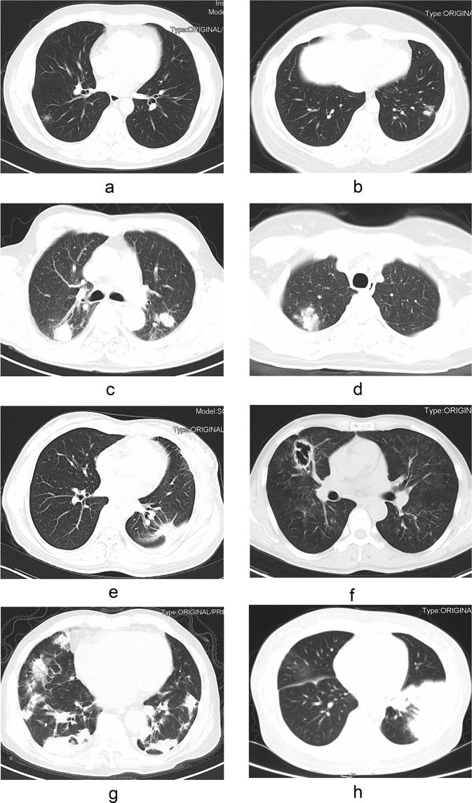 https://cdn.ncbi.nlm.nih.gov/pmc/blobs/b818/7287058/4772f0dc0fc4/41598_2020_66094_Fig1_HTML.jpg
