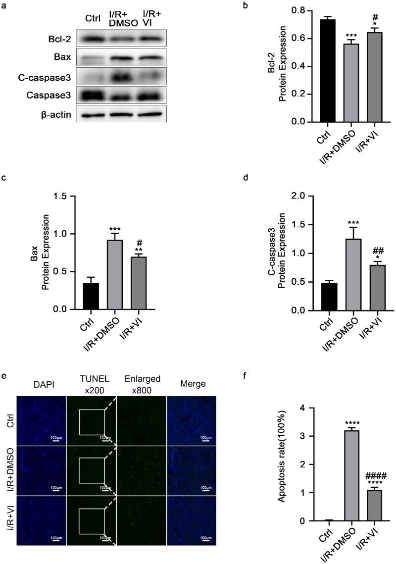 https://cdn.ncbi.nlm.nih.gov/pmc/blobs/b81a/11834780/22adec97e170/IRNF_A_2463572_F0004_C.jpg