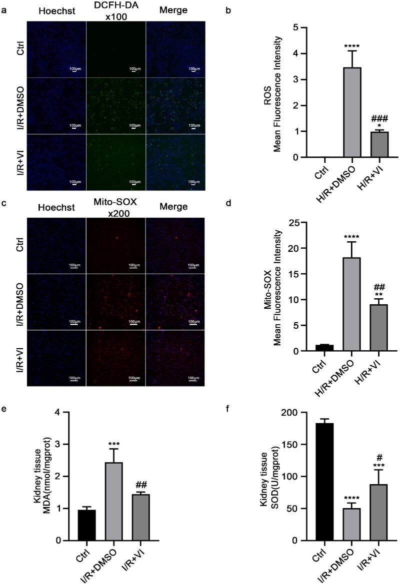 https://cdn.ncbi.nlm.nih.gov/pmc/blobs/b81a/11834780/f22ec87dcbe8/IRNF_A_2463572_F0002_C.jpg