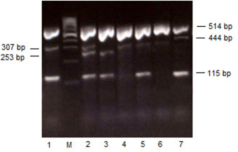 https://cdn.ncbi.nlm.nih.gov/pmc/blobs/b822/10637921/ac57664980f4/gr1.jpg