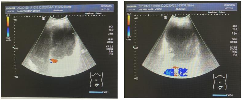 https://cdn.ncbi.nlm.nih.gov/pmc/blobs/b823/11165209/031fa0f5dbef/fonc-14-1377042-g002.jpg