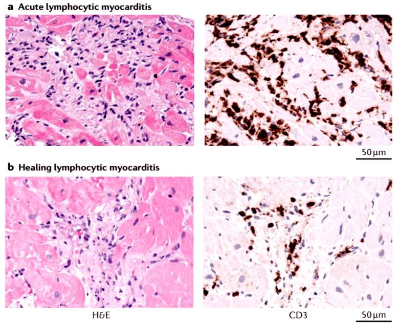 https://cdn.ncbi.nlm.nih.gov/pmc/blobs/b826/12031395/b1195116ab06/viruses-17-00484-g003.jpg