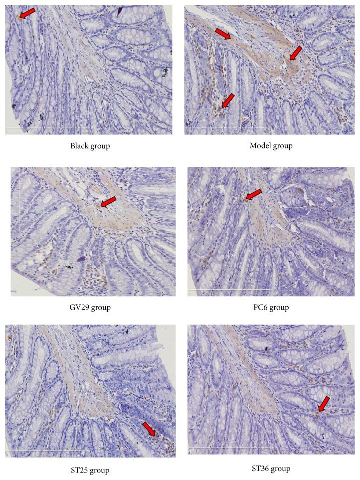 https://cdn.ncbi.nlm.nih.gov/pmc/blobs/b82b/6377955/8515ba6553f8/ECAM2019-4213928.006.jpg